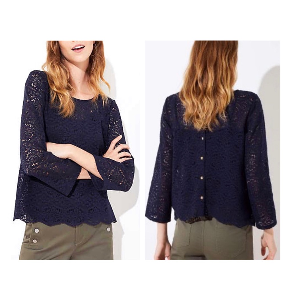 Loft Button Back Lace Top - image 1